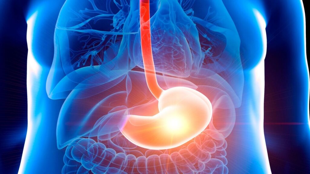 Câncer de estômago: H. Pylori é um dos principais fatores de risco para a doença
