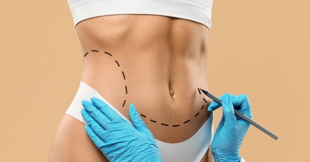 Cirurgia plástica busca naturalidade e equilíbrio