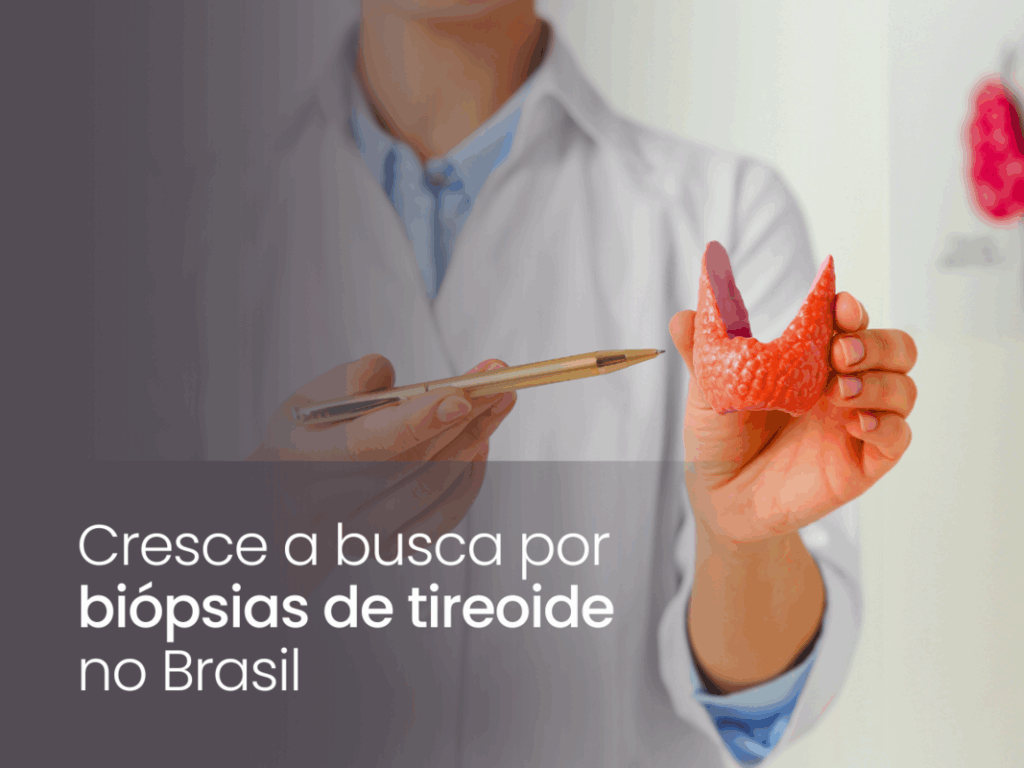 Cresce a busca por biópsias de tireoide no Brasil