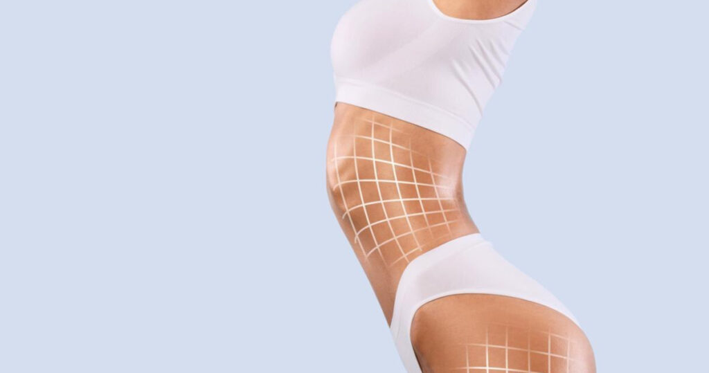 Lipo com tecnologias indica avanço na cirurgia plástica