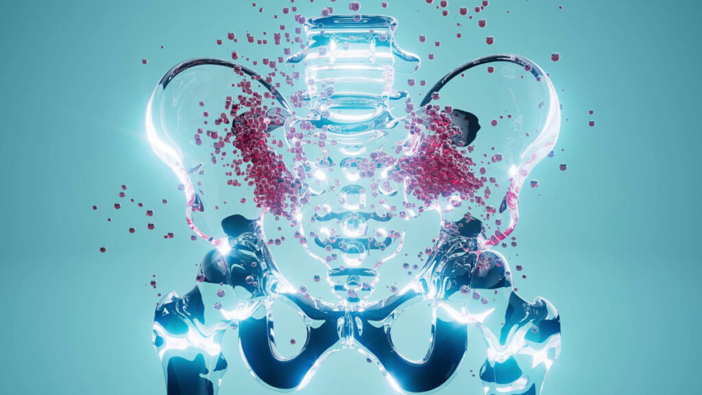 Cirurgia robótica amplia tratamento da endometriose Cirurgia robótica amplia tratamento da endometriose