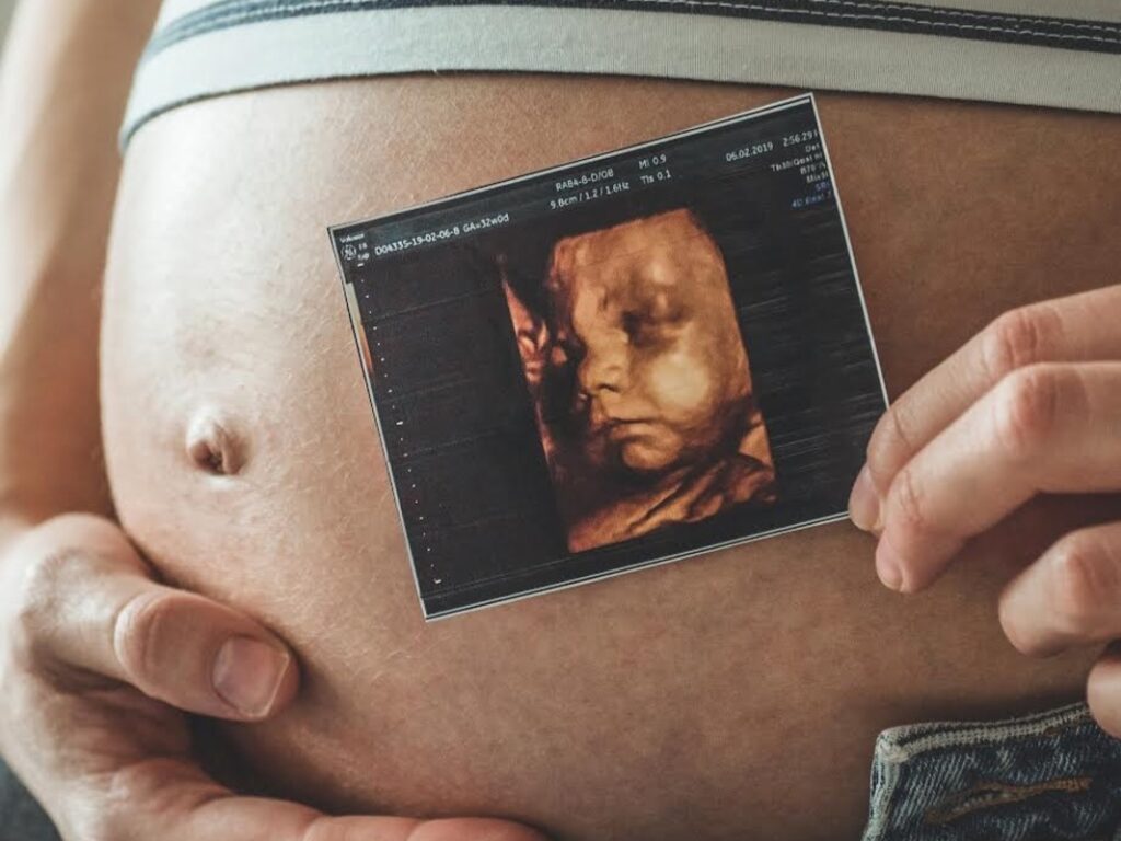 Ultrassonografia obstétrica avança no diagnóstico pré-natal Ultrassonografia obstétrica avança no diagnóstico pré-natal