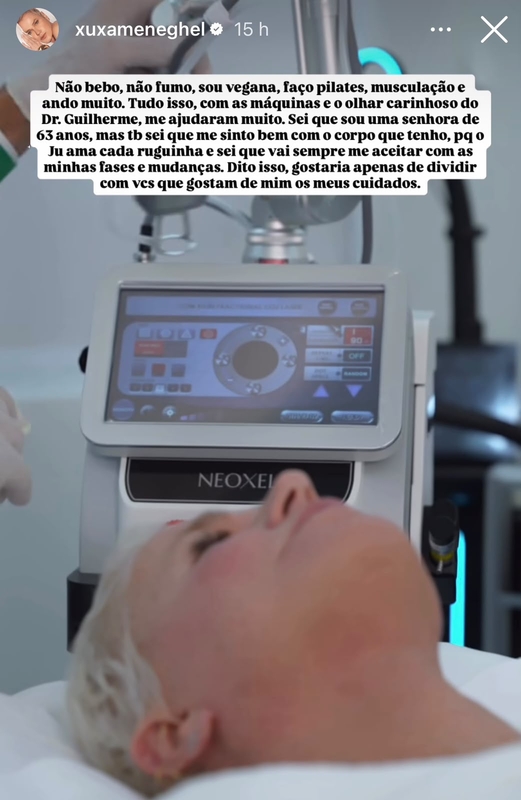 Laser de CO2 Neoxel ganha destaque com Xuxa Laser de CO2 Neoxel ganha destaque com Xuxa