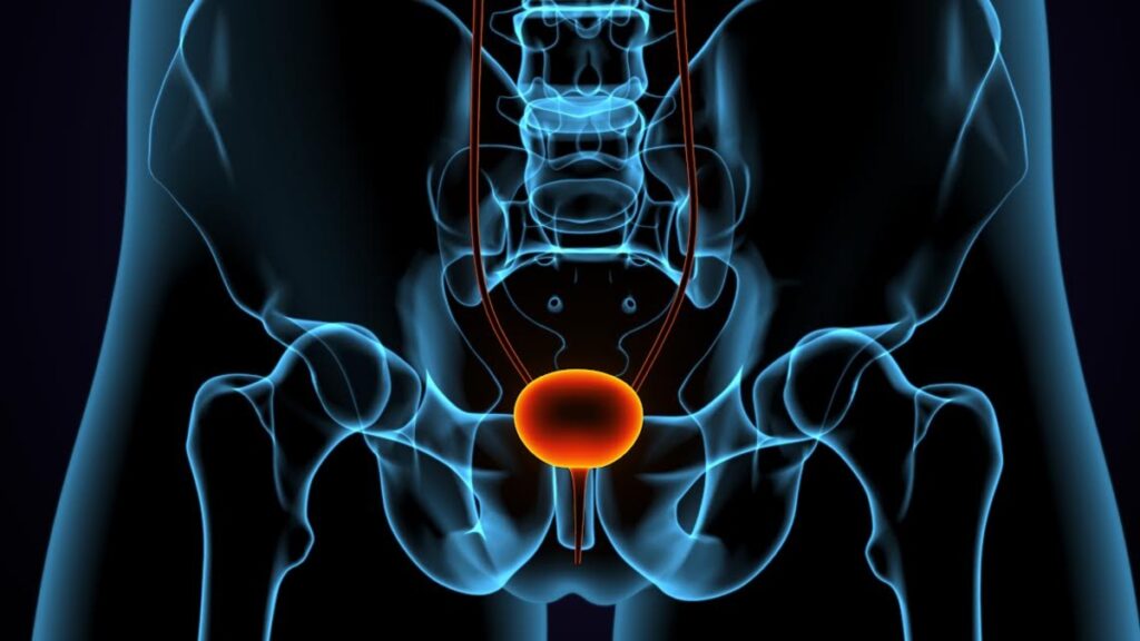 Urologista explica diferenças entre HPB e câncer de próstata Urologista explica diferenças entre HPB e câncer de próstata