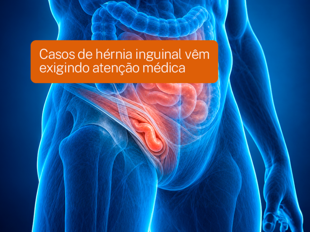 Casos de hérnia inguinal vêm exigindo atenção médica Casos de hérnia inguinal vêm exigindo atenção médica