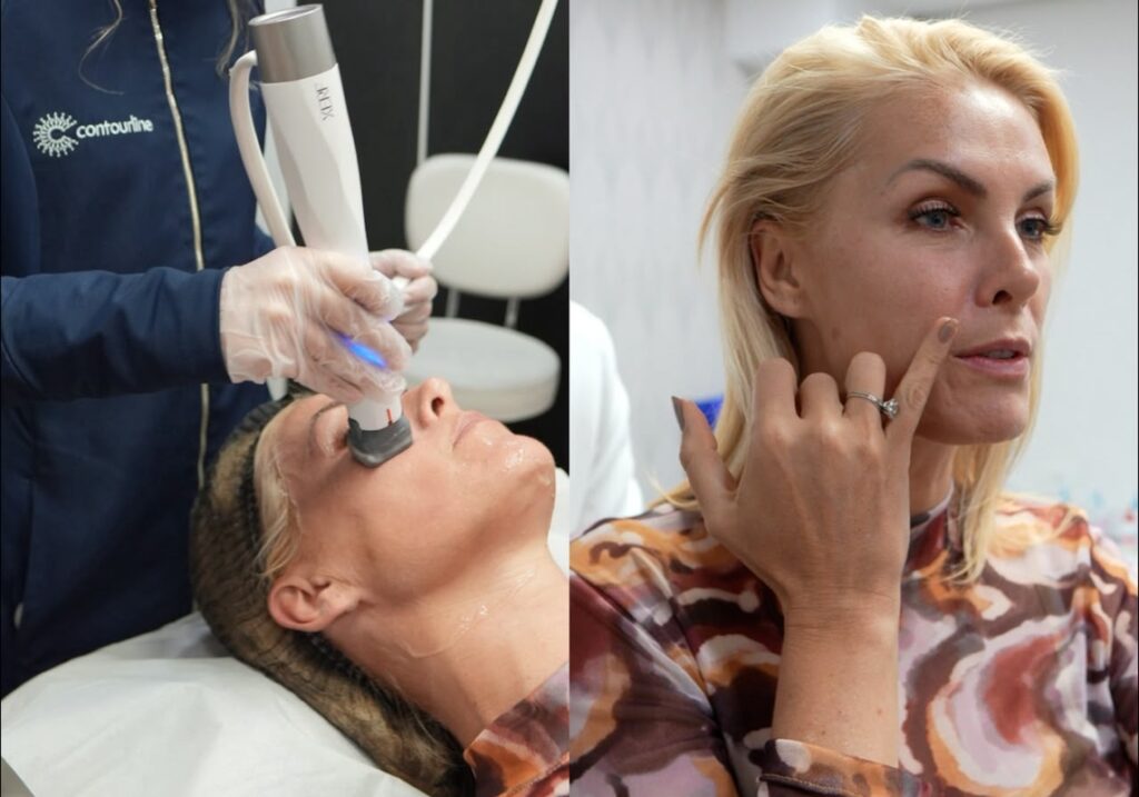 XERF conquista celebridades que buscam a renovação da beleza XERF conquista celebridades que buscam a renovação da beleza
