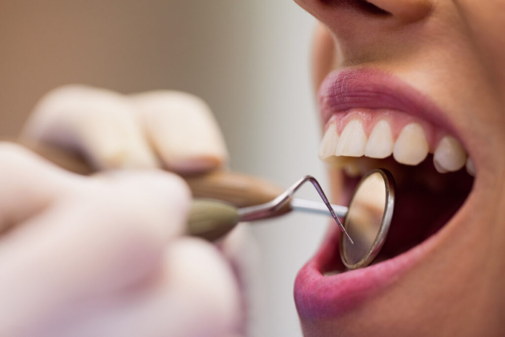 Sangramento na gengiva pede avaliação, alerta dentista Sangramento na gengiva pede avaliação, alerta dentista